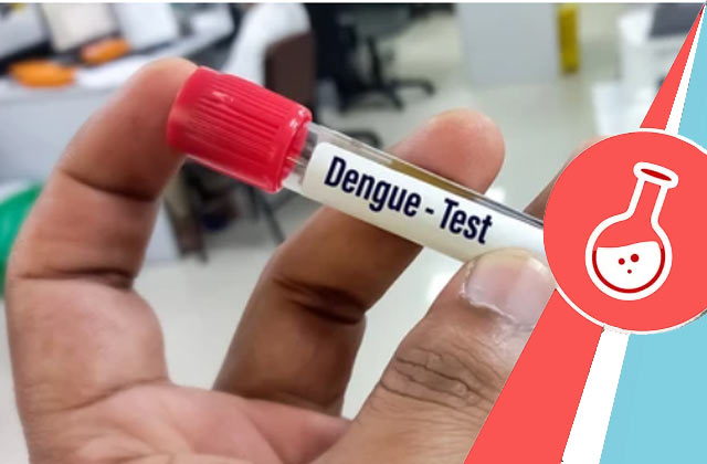 Dengue Ns1 Antigen Rapid Test