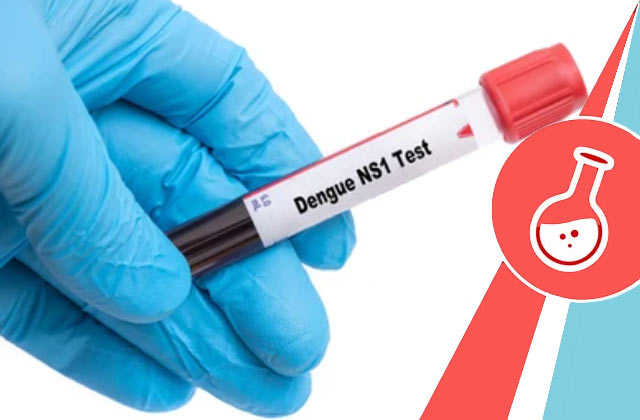 Dengue Ns1 Antigen Test