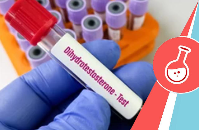 Dihydrotestosterone test