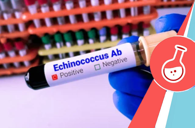 Echinococcus IgG Test (Hydatid Serology)