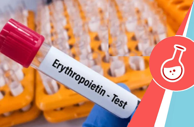 Erythropoietin Test (EPO)