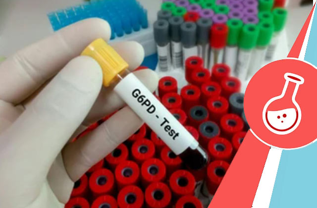 G6PD Blood Test 