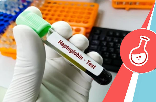 Haptoglobin Blood Test