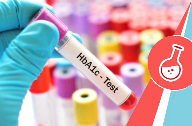 HbA1c Test (Glycosylated Hemoglobin)