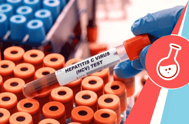 Anti-HCV Test (Hepatitis C Test)