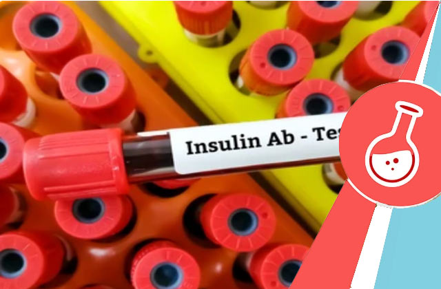 Insulin Antibody Test
