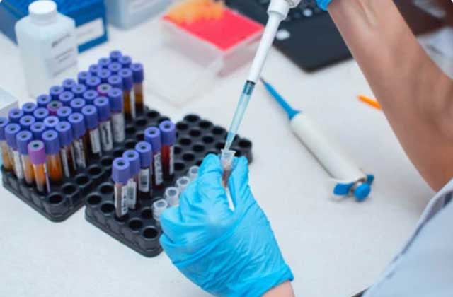 Lipid Profile Test in West Tripura