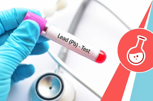 Lead Blood Test (Lead Screening)