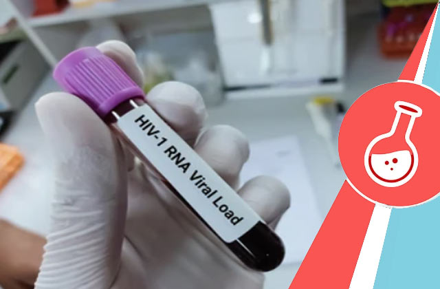 HIV-1 RNA Qualitative PCR