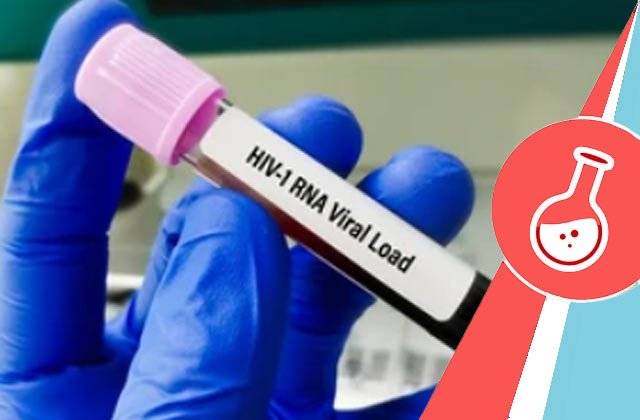 HIV-1 RNA Quantitative PCR