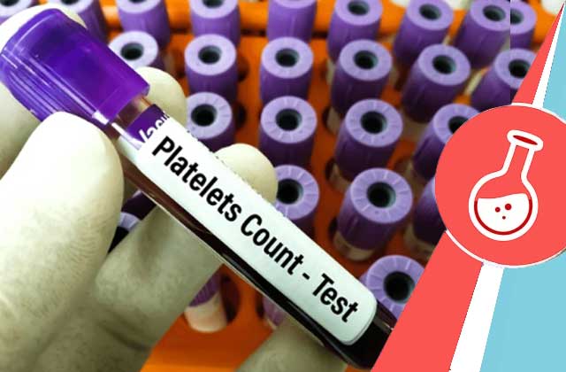 Platelet count test