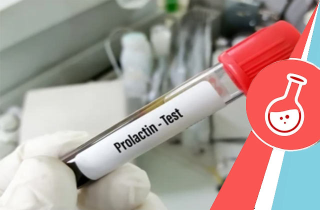 Prolactin Test (PRL Test)