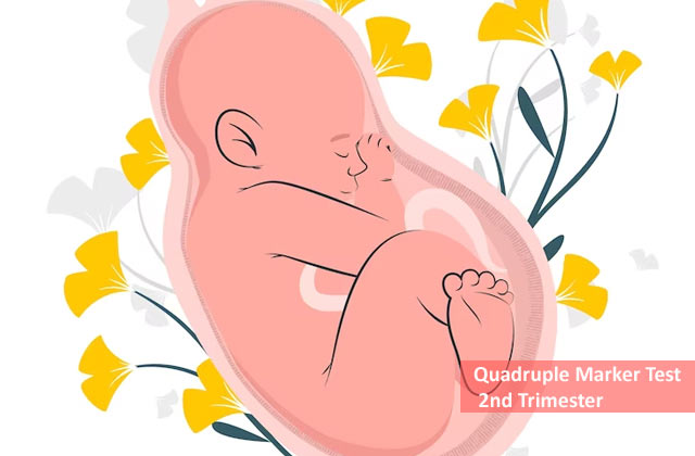 quadruple test in pregnancy