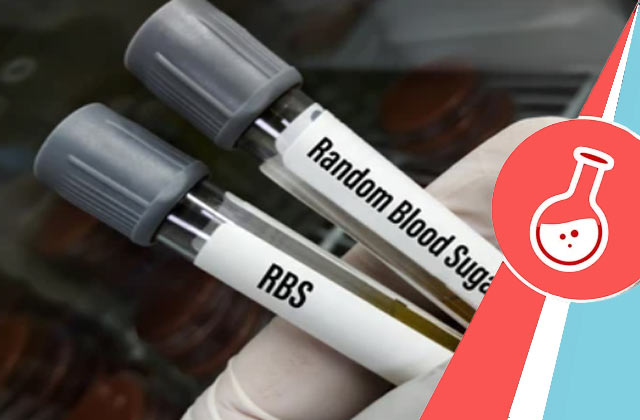 RBS Test (Random Blood Sugar Test)