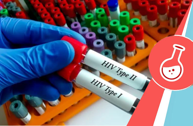 hiv 1 and 2 test