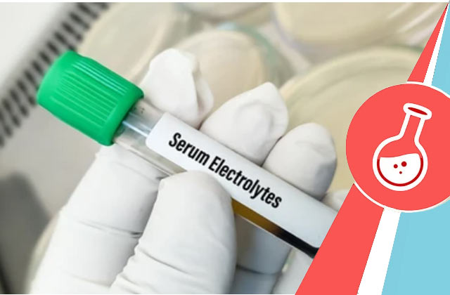 Electrolytes Serum Test