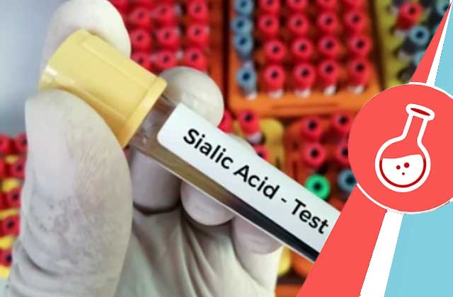 Sialic Acid Test