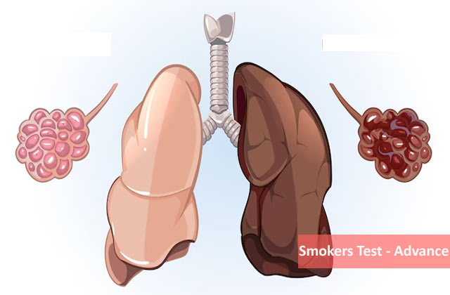 Smokers Test - Advance