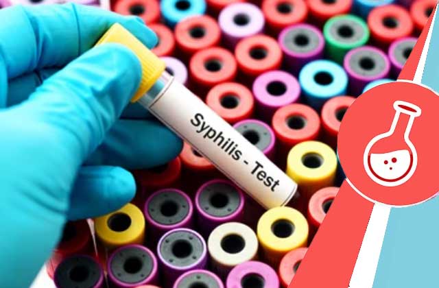Syphilis Rapid Test