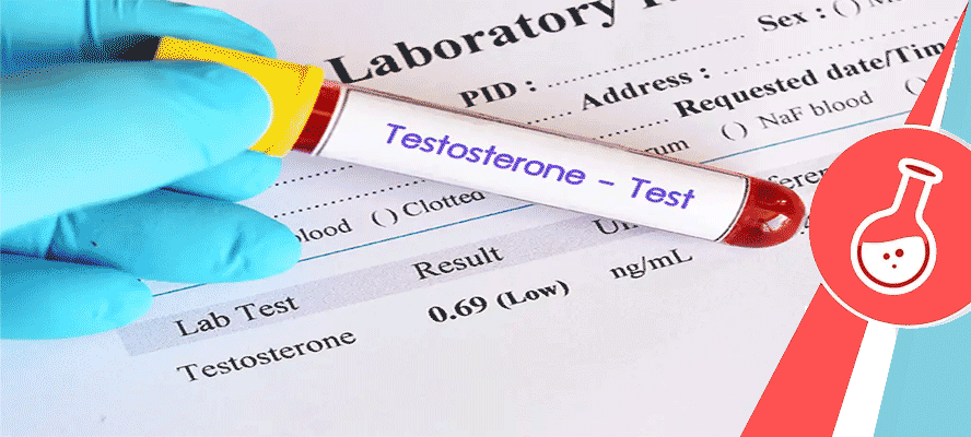 Testosterone Test 