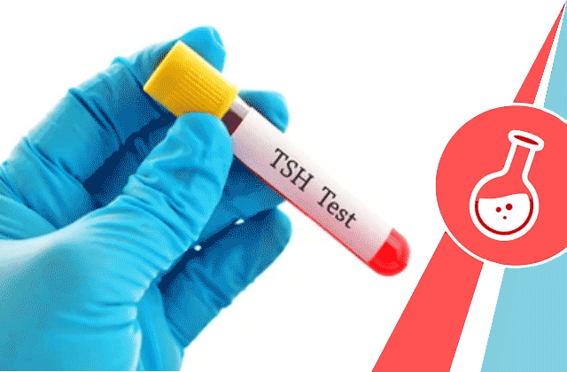 TSH Test (Thyroid Stimulating Hormone Test)