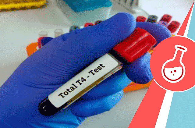 Total Thyroxine (T4) Test