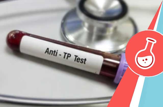 treponema pallidum antibody test