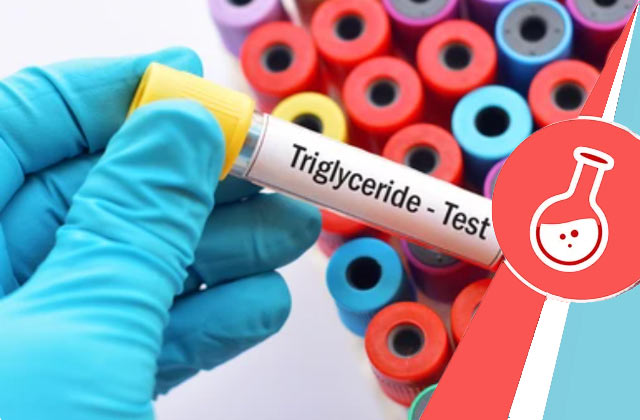 Triglycerides Test
