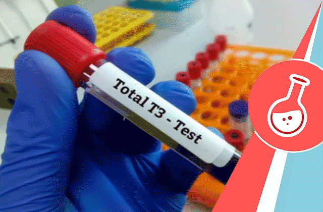Total Triiodothyronine (T3) Test