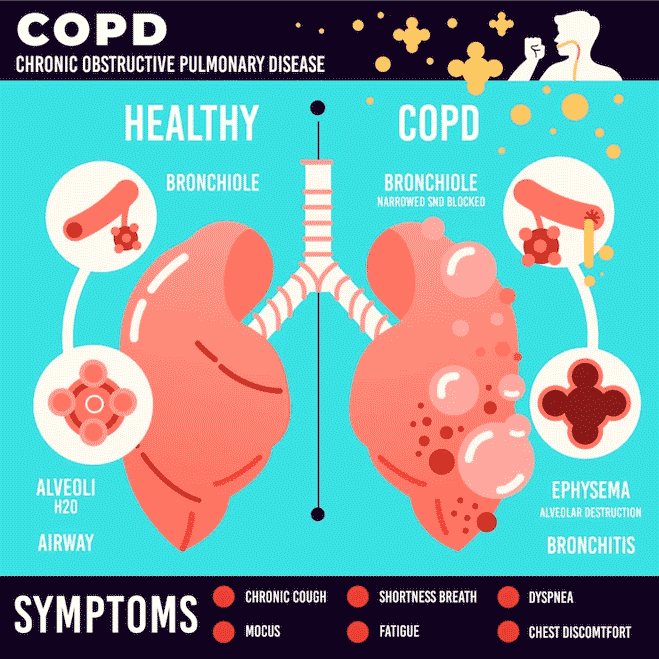 Symptoms of chronic lungs disease Symptoms of chronic lungs disease