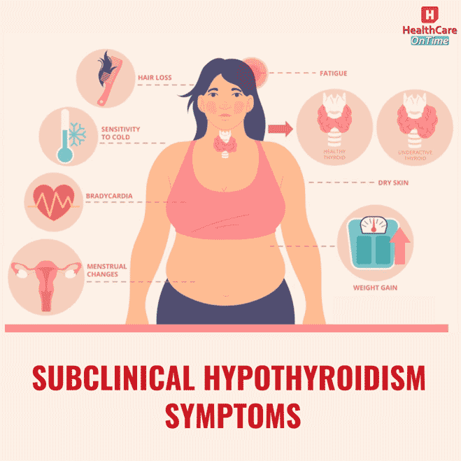 subclinical hypothyroidism symptoms subclinical hypothyroidism symptoms