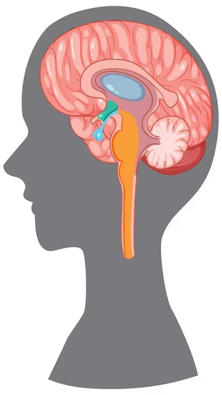 8 Warning Signs Of Brain Stroke