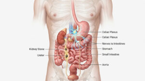 Anatomical illustration of human digestive system with labeled organs and kidney stone detail.