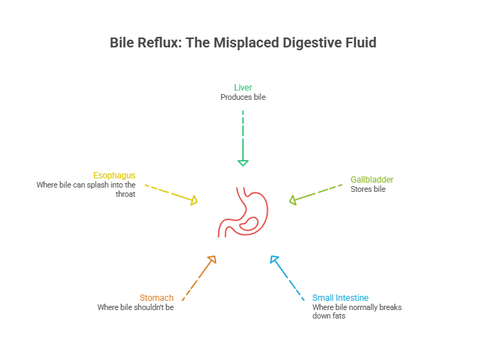Infographic explaining bile reflux with labeled organs: liver, gallbladder, stomach, small intestine, and esophagus.