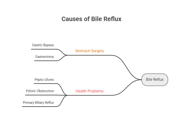 Diagram showing causes of bile reflux including gastric bypass, gastrectomy, peptic ulcers, pyloric obstruction, and primary biliary reflux. Infographic.