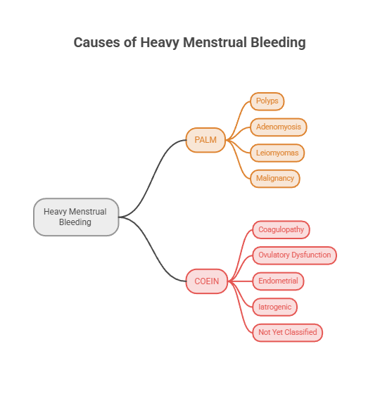Mind map showing causes of heavy menstrual bleeding with PALM and COEIN categories and their subtypes. Infographic.