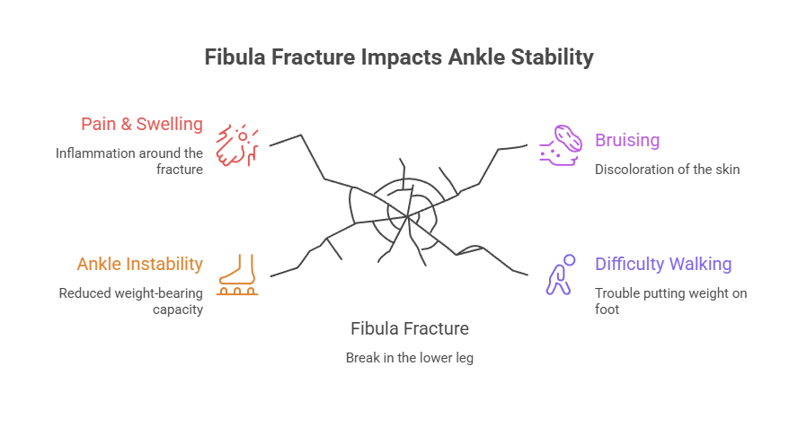 Infographic showing effects of fibula fracture on ankle stability with pain, swelling, bruising, and difficulty walking.