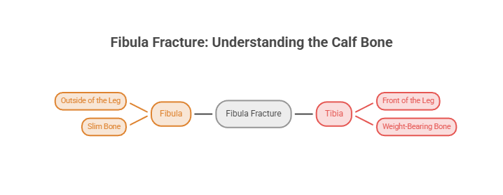 Infographic explaining fibula fracture with labels for fibula, tibia, and related characteristics.