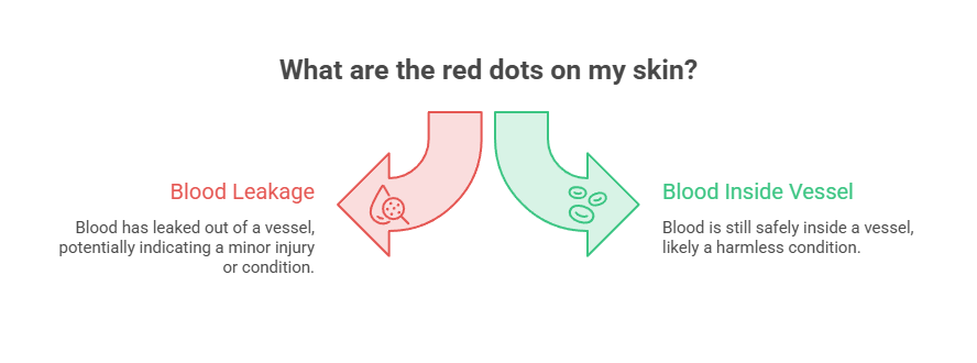 Infographic explaining red dots on skin, showing blood leakage and blood inside vessel with descriptions.