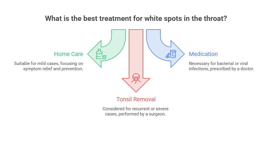 Infographic showing treatment options for white spots in the throat: Home Care, Medication, and Tonsil Removal.