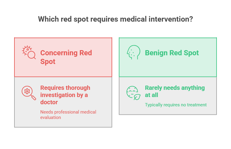 Infographic comparing concerning and benign red spots, detailing medical intervention needs and evaluations.