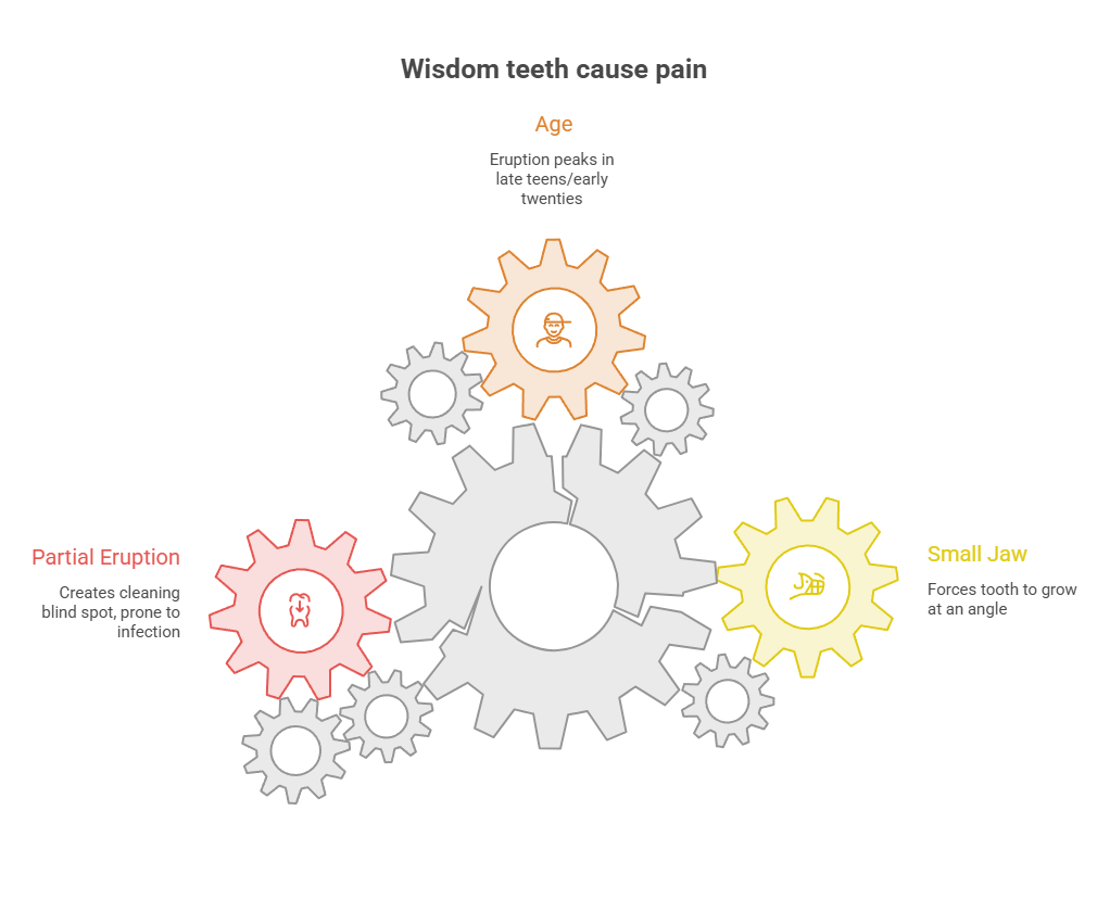Infographic explaining causes of wisdom teeth pain with gears, age, partial eruption, and small jaw factors.