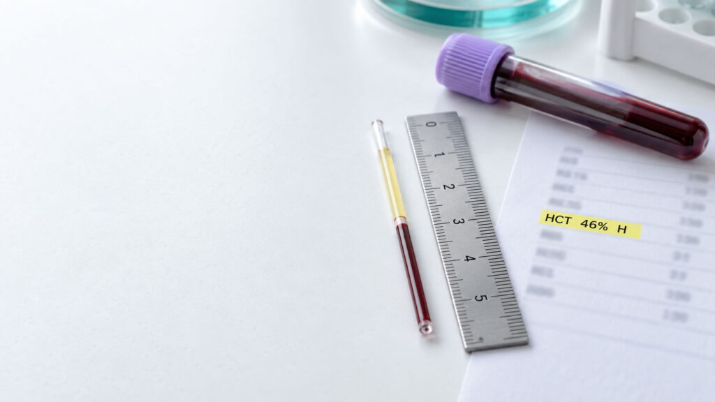 A blood test setup with a ruler, test tubes, and a report showing HCT 46% H on a white surface.