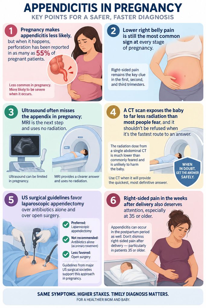 Infographic on appendicitis in pregnancy, detailing key points and statistics with illustrations of women and medical procedures.