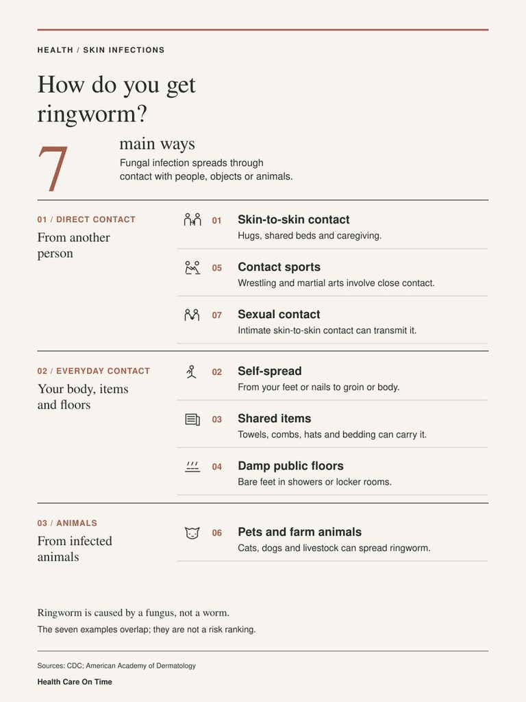 Infographic showing 7 ways to get ringworm, including skin-to-skin contact and pets spreading infection.