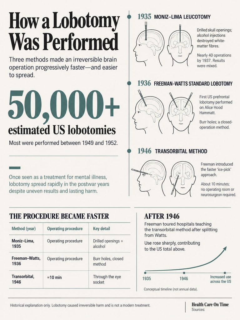 Infographic showing how lobotomies were performed, detailing methods, statistics, and historical context.