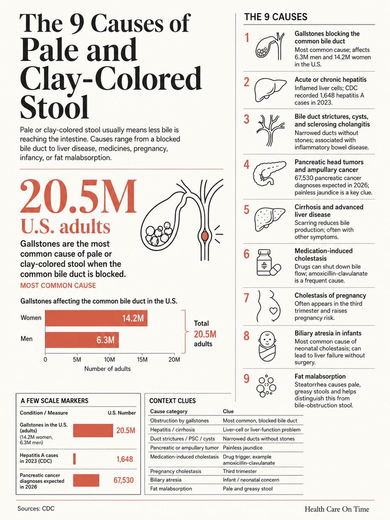 Infographic showing 9 causes of pale and clay-colored stool with statistics and illustrations of each cause.