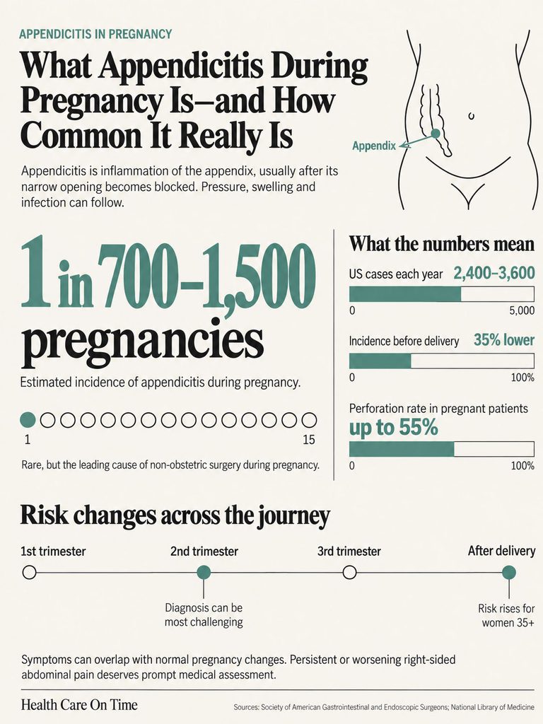 Infographic explaining appendicitis in pregnancy, showing statistics and risk changes across trimesters.