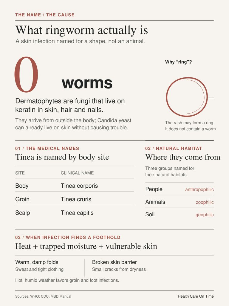 Infographic explaining ringworm, its causes, types, and conditions for infection with illustrations and text.