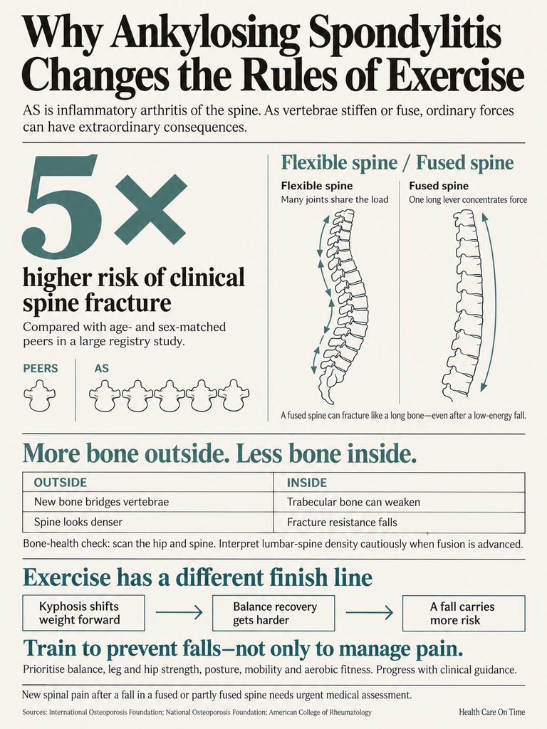 Infographic explaining ankylosing spondylitis and exercise rules, showing spine differences and fracture risks.